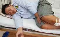 Khởi tố vụ án chém công an trọng thương ở Gia Lai