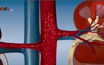 Vitamin B giúp tránh suy thận ở trẻ mắc bệnh tiểu đường tuýp 1