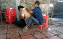 Nam thanh niên liệt hai chân vì "cắt lễ" trị đau lưng