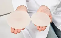 Đặt túi ngực có thể gây ung thư?