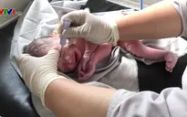 Tỷ lệ sinh toàn cầu giảm rõ rệt