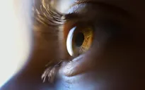 Những tác hại của thuốc lá lên đôi mắt ít ai biết