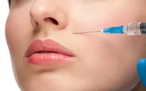 Tiêm filler thế nào mới an toàn?