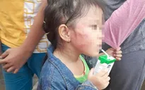 Xét xử bảo mẫu bạo hành trẻ ở cơ sở mầm non Ánh Sao Vàng, TP.HCM