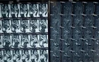 Chấm dứt 15 năm đau đớn vì lạc nội mạc tử cung