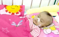 Giành sự sống cho bệnh nhi hẹp khí quản kèm sửa dị tật tim bẩm sinh