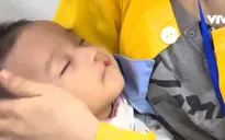 Trẻ có khe hở môi - vòm miệng có thể khắc phục triệt để?