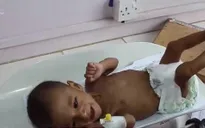 Những đứa trẻ bị mắc kẹt trong cuộc khủng hoảng tại Yemen