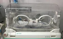 Hành trình nuôi sống trẻ sinh non 26 tuần tuổi nặng 600 gram