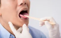 14 loại mùi hôi báo hiệu sự bất ổn của cơ thể