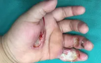 Bé 1 tuổi bị điện giật hôn mê do nghịch máy bơm nước