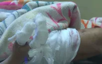 Vụ nổ ở Bắc Ninh: Nhặt đầu đạn sót lại, một người dân bị dập nát bàn tay, nhiều mảnh đạn găm vào cơ thể