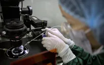 Liệu pháp biến đổi gen có thể chữa khỏi HIV/AIDS