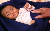 Cảnh báo khủng hoảng lương thực ở Yemen