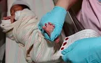 Sàng lọc trước sinh và sơ sinh: Tránh hậu quả nặng nề do dị tật