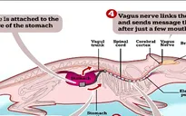 Thiết bị phát tín hiệu báo - giải pháp điều trị cho chứng béo phì