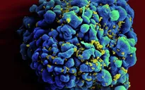 Các nhà khoa học Pháp đã tìm ra cách tiêu diệt các tế bào bị nhiễm HIV