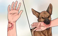 Tử vong vì bệnh dại sau 4 tháng bị chó lạ cắn