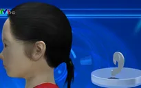 Cấy ghép tai cho trẻ bị dị tật bẩm sinh