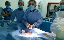 Phương pháp điều trị u gan mới