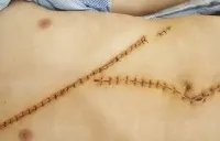 Cứu sống bệnh nhân với nhiều vết thương do bị đâm, chém