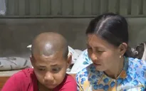 Người mẹ 17 năm cưu mang con nuôi mắc bệnh u não