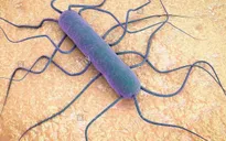 WHO cảnh báo nguy cơ lây lan vi khuẩn Listeria