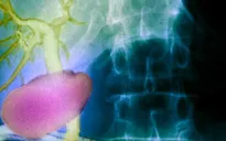 Khám phá ra cơ quan chưa từng biết đến trong cơ thể người, mở ra phương pháp điều trị ung thư mới