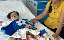 Cứu sống bé 17 tháng tuổi uống nhầm xăng đựng trong chai nước giải khát