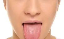 Nguyên nhân không ngờ gây ngứa lưỡi