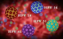Các giai đoạn phát triển của ung thư cổ tử cung do nhiễm HPV