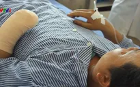 Phẫu thuật thành công cho bệnh nhân dập nát bàn tay do nổ đèn pin