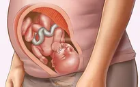 Phát hiện sớm dị tật ở thai nhi và trẻ em