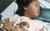 Thông tin về cháu bé nổi mẩn khắp người sau khi uống trà sữa