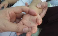 Nghệ An: Bệnh ho gà và tay chân miệng gia tăng