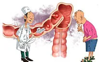 Cảnh báo: Hơn 20% dân số Việt Nam mắc bệnh viêm đại tràng