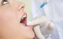 Cẩn trọng: Dùng thuốc tê khi nhổ răng có thể gây ngộ độc