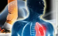 Cảnh báo: Tỷ lệ mắc mới ung thư ở nam giới gia tăng nhanh