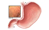 Những dấu hiệu cho thấy dạ dày bạn đang gặp vấn đề