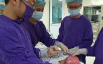 Khối u xơ tử cung nặng bằng em bé sơ sinh