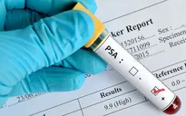 Những điều cần biết về chất chỉ điểm ung thư