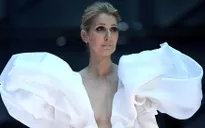 Trước khi phẫu thuật, khả năng nghe của Celine Dion rất kém