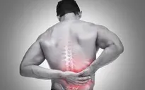 Phát hiện mới trong chữa trị bệnh đau lưng