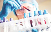 Phương pháp xét nghiệm máu mới giúp phát hiện ung thư từ rất sớm