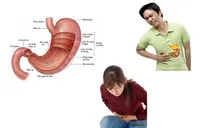 Ai dễ bị ung thư dạ dày?