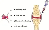 Tế bào gốc trung mô giúp tăng tuần hoàn máu cho bệnh nhân tiểu đường