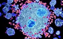 Liệu pháp gien sử dụng tế bào gốc tạo máu trong điều trị HIV/AIDS