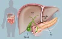 Chẩn đoán sớm - yếu tố quan trọng trong điều trị ung thư tụy