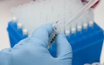 Virus Zika có thể tiêu diệt các tế bào tạo thành khối u não ác tính?