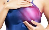 Phát triển loại thuốc chẩn đoán sớm ung thư vú